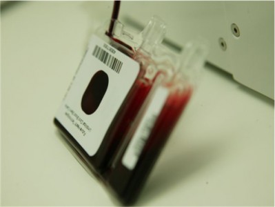 Cord Blood sample