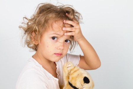 Measles how to help