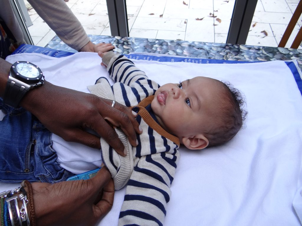 Febrile Convulsions