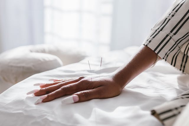 hand with acupuncture needles
