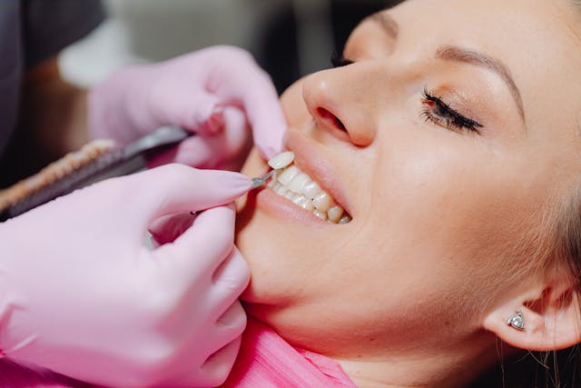 veneers