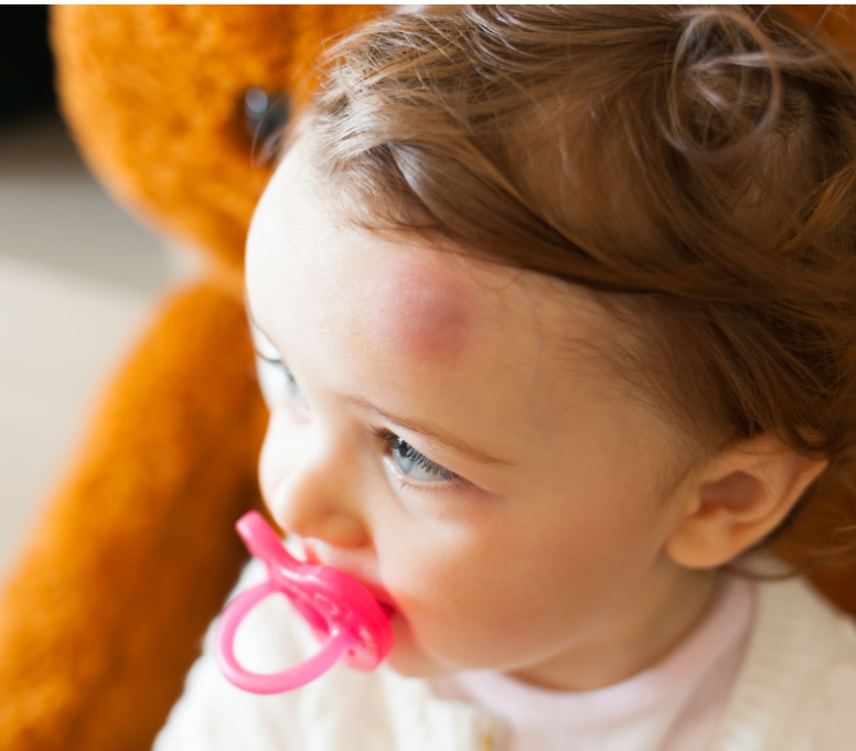 Learning first aid for toddlers